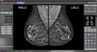 Управление маммограф Bemems Pinkview DR