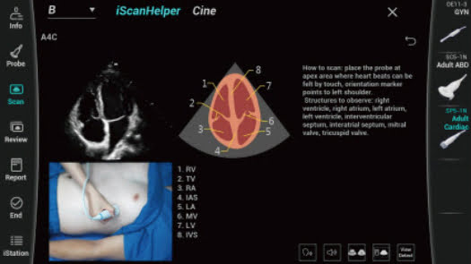 iScanHelper – руководство по сканированию в виде изображения и текста для ультразвукового аппарата Consona N6