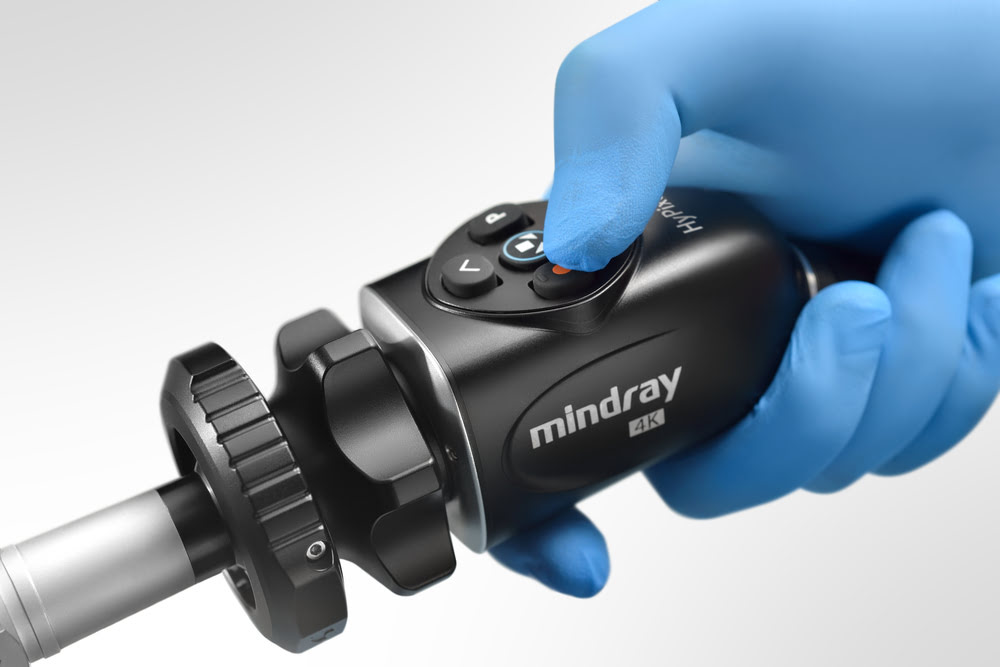 Запись видео на Mindray HyPixel U1 можно включить одной кнопкой, запись ведётся на USB или жёсткий диск