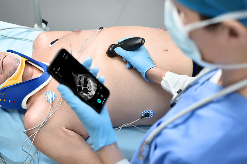 Карманный датчик-сканер Mindray ТЕ Air i3P – удобное управление со смартфона