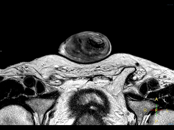 Технологии 3D BrainVIEW и SpineVIEW Philips Ingenia Ambition 1.5T S позволяют получить данные в высоком разрешении в разных проекциях, в том числе в наклонных за одно сканирование