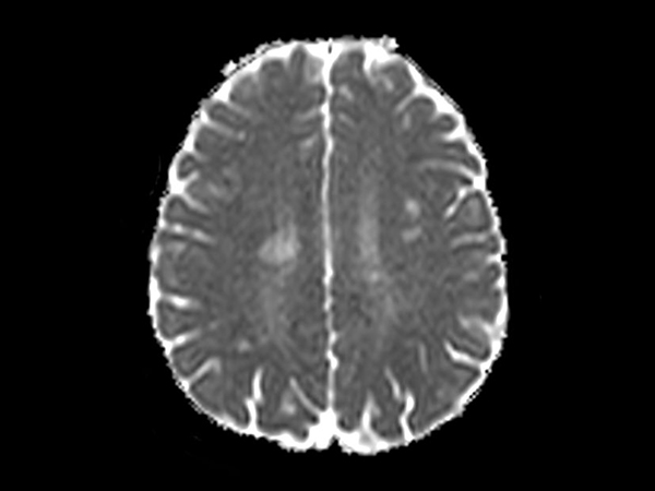 SmartAssist оптимизирует работу оператора и берет на себя большую часть рутинных действий: от позиционирования до анализа результатов