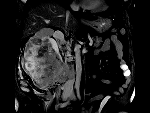 12-дюймовый сенсорный экран VitalScreen отражает информацию об сканировании и инструкции для пользователя (продолжительность исследования, используемая катушка, позиционирование и физиологическое состояние пациента, сведения об используемом контрастном веществе и указания по задержке дыхания).