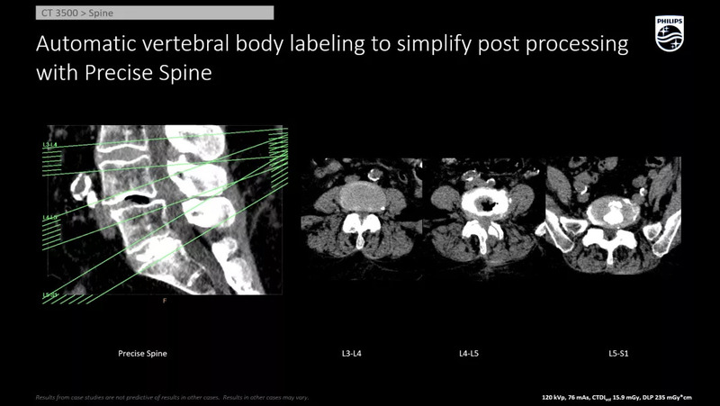 Система компьютерной томографии Philips CT 3500