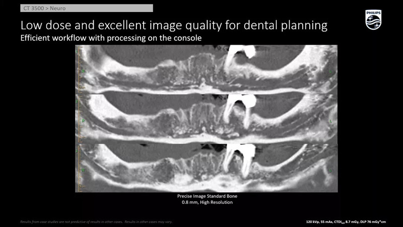Система компьютерной томографии Philips CT 3500