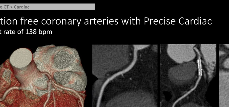 Система компьютерной томографии Philips Incisive CT