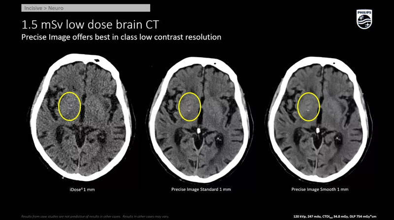 Система компьютерной томографии Philips Incisive CT