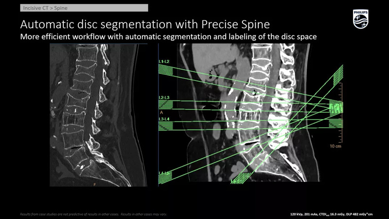 Система компьютерной томографии Philips Incisive CT