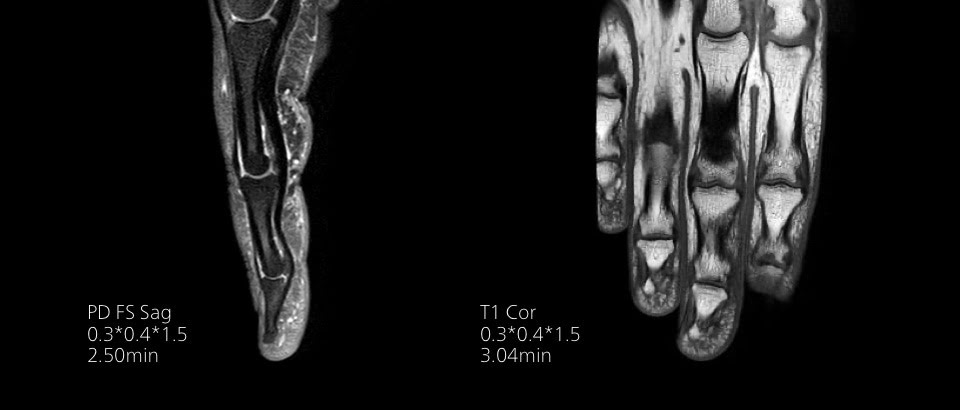 МРТ Philips MR 5300: технология SmartSpeed ускоряет визуализацию в 3 раза, увеличивает разрешение на 65%, совместима с 97% клинических протоколов (2D/3D, в том числе с широким спектром современных методов контрастирования)