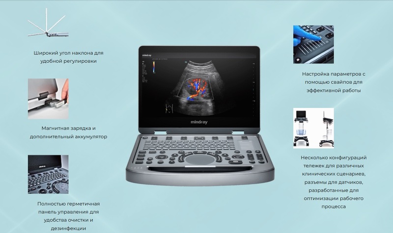 Портативный ультразвуковой аппарат Mindray MX6 на платформе ZST+ обеспечивает врачам комфорт и простоту работы за счет широкого угла наклона светодиодного дисплея, сенсорной настройки параметров, наличия встроенного аккумулятора и трех активных разъемов для датчиков.