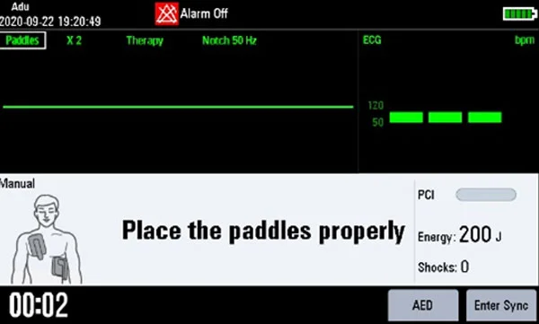 Уникальная технология ResQNavi™ оценивает подготовку врача и помогает ему на всех этапах реанимации пациента, опираясь на уровень его опыта и уверенность при проведении реанимации, предлагая при необходимости более подробные инструкции.