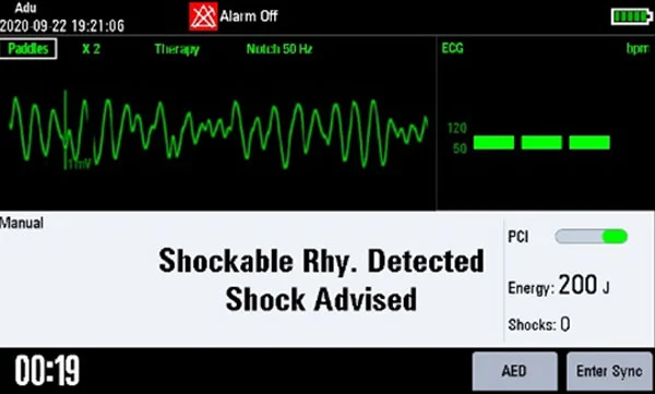 Уникальная технология ResQNavi™ оценивает подготовку врача и помогает ему на всех этапах реанимации пациента, опираясь на уровень его опыта и уверенность при проведении реанимации, предлагая при необходимости более подробные инструкции.