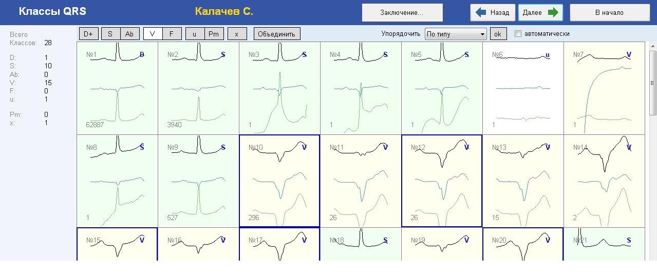 Qrs на экг что это. QRS-анализ. Анализ комплекса QRS. Каналы ЭКГ Холтер. ЭКГ BPLAB.