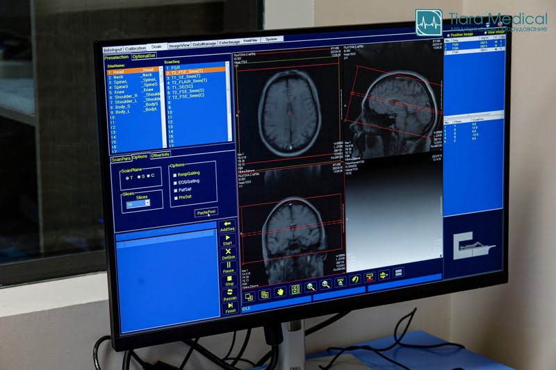 Basda BTI 050 – диагностика головного мозга, позвоночника, суставов, внутренних органов с отличной визуализацией