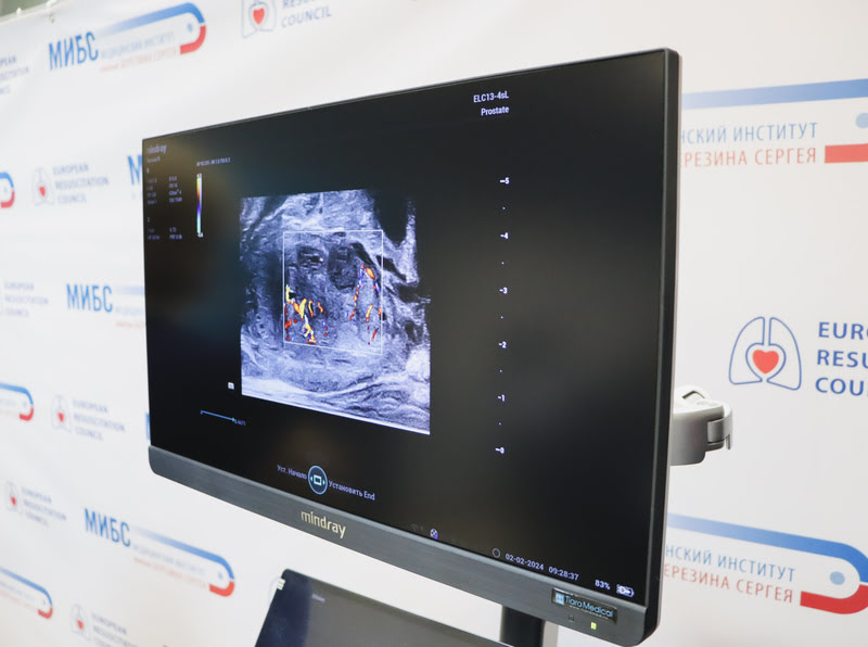 УЗИ-система Resona I9 Mindray – наиболее популярный УЗИ-сканер, обеспечивающий чёткость и детализированность изображений, простоту управления и широкий выбор возможностей диагностики