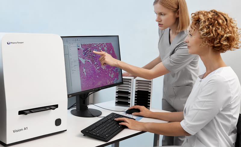 Автоматизация микроскопии в гистологической лаборатории позволяет повысить качество исследований, а цифровой документооборот через ЛИС упрощает и ускоряет обмен данными между патологоанатомами и клиницистами.