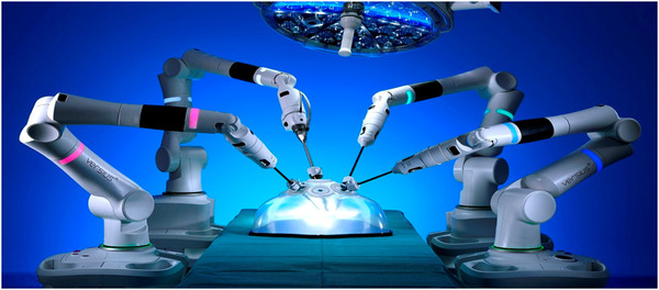 Система Versius может быть оснащена до 5 манипуляторов. Каждый из них представляет собой отдельную роботизированную единицу, предназначенную для большей свободы размещения портов. Технология V-Wrist обеспечивает 7 степеней свободы, движение запястья на 360° и тактильную обратную связь.