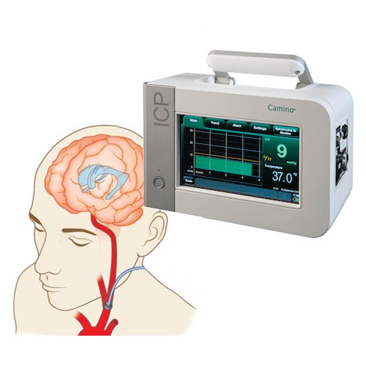 Нейромониторы - Мониторинг пациента