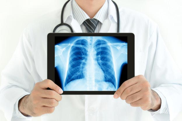 Цифровая рентгенография